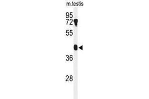 Western blot analysis of B4GALT2 Antibody (C-term) in mouse testis tissue lysates (35µg/lane). (B4GALT2 anticorps  (C-Term))