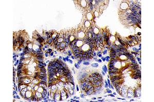 Immunohistochemistry analysis of paraffin-embedded rat colon using E-Cadherin Monoclonal Antibody at dilution of 1:300.