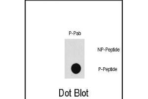 Dot blot analysis of Phospho-P3K7- polyclonal antibody (Cat. (MAP3K7 anticorps  (pThr187))