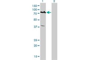 Western Blot analysis of ALS2CR8 expression in transfected 293T cell line by ALS2CR8 monoclonal antibody (M01), clone 2A3.