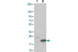 Western blot analysis of Lane 1: Negative control (vector only transfected HEK293T lysate). (CCDC56 anticorps)