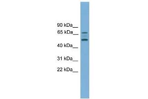 WB Suggested Anti-ACVR2B Antibody Titration:  0.