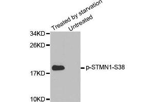 Western blot analysis of extracts from K562 cells, using Phospho-STMN1-S38 antibody. (Stathmin 1 anticorps  (pSer38))