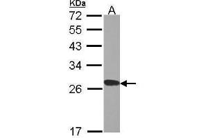 WB Image Sample (30 ug of whole cell lysate) A: H1299 12% SDS PAGE RPL15 antibody antibody diluted at 1:1000 (RPL15 anticorps)