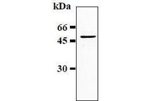 Western Blotting (WB) image for anti-Glial Fibrillary Acidic Protein (GFAP) antibody (ABIN1449150) (GFAP anticorps)