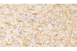 Detection of TUBb1 in Mouse Cerebrum Tissue using Polyclonal Antibody to Tubulin Beta 1 (TUBb1)