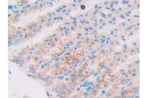 Detection of UCP2 in Rat Stomach Tissue using Polyclonal Antibody to Mitochondrial Uncoupling Protein 2 (UCP2)