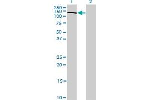 Western Blot analysis of PIK3R4 expression in transfected 293T cell line by PIK3R4 monoclonal antibody (M01), clone 1D4.