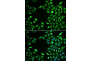 Immunofluorescence analysis of A549 cell using INTS6 antibody. (INTS6 anticorps)