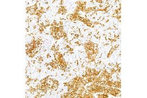 Immunohistochemistry (IHC) image for anti-Protein tyrosine Phosphatase, Receptor Type, C (PTPRC) (C-Term) antibody (ABIN7454030)
