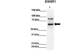 Lanes:   Lane 1: 50ug Hela Lysate  Primary Antibody Dilution:   1:1000  Secondary Antibody:   Anti-rabbit-HRP  Secondary Antibody Dilution:   1:10,000  Gene Name:   EWSR1  Submitted by:   Archa Fox, University of Western Australia  EWSR1 is strongly supported by BioGPS gene expression data to be expressed in Human HeLa cells
