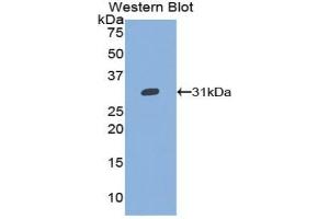 Detection of Recombinant GP5, Mouse using Polyclonal Antibody to Cluster of Differentiation 42d (CD42d) (GP5 anticorps  (AA 246-485))