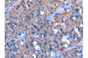 Detection of CYP1B1 in Human Stomach Tissue using Polyclonal Antibody to Cytochrome P450 1B1 (CYP1B1)