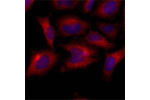 Immunofluorescence of human HeLa cells stained with Hoechst 3342 (Blue) for nucleus staining and BAK1 monoclonal antibody, clone AT8B4  (1 : 500) with Texas Red (Red). (BAK1 anticorps  (AA 29-187))