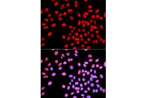 Immunofluorescence analysis of U2OS cell using IKZF1 antibody. (IKZF1 anticorps  (AA 1-270))