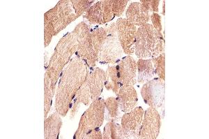 Immunohistochemical analysis of paraffin-embedded H. (CARD6 anticorps)