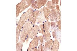 Immunohistochemical analysis of paraffin-embedded H. (CARD6 anticorps)