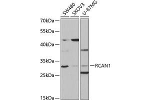 Western blot analysis of extracts of various cell lines, using RC antibody (ABIN6129452, ABIN6146811, ABIN6146812 and ABIN6220955) at 1:1000 dilution. (RCAN1 anticorps  (AA 60-245))