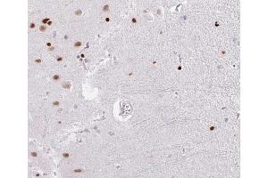 ABIN6266529 at 1/100 staining human brain tissue sections by IHC-P. (DP1 anticorps  (C-Term))