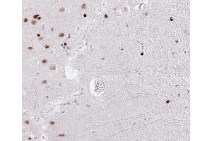 ABIN6266529 at 1/100 staining human brain tissue sections by IHC-P. (DP1 anticorps  (C-Term))