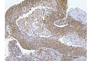 IHC analysis of AGPS using anti-AGPS antibody (ABIN7600146). (AGPS anticorps  (AA 154-658))