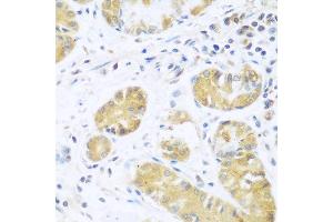 Immunohistochemistry of paraffin-embedded human stomach using UCHL3 antibody at dilution of 1:100 (40x lens). (UCHL3 anticorps)