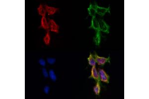 ABIN6262174 and ABIN6269018 staining HepG2 by IF/ICC.
