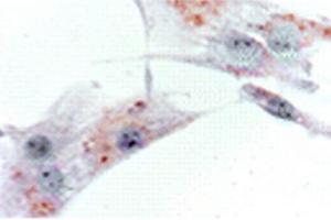 anti-Prokineticin Receptor 2 (PROKR2) (N-Term) antibody