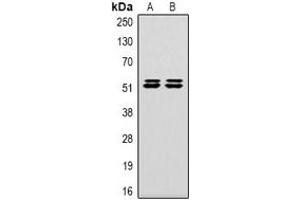 Western blot analysis of Carbonic Anhydrase 9 expression in Hela (A), 293T (B) whole cell lysates. (CA9 anticorps)