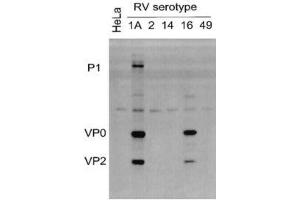 Lysates of HeLa cells infected with RV serotypes 1A, 2, 14, 16 or 49 and blotted with ABIN1000236 (Rhinovirus 16 anticorps)