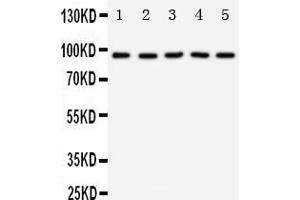 Anti-TrkC antibody, Western blotting Lane 1: Rat Brain Tissue Lysate Lane 2: Mouse Brain Tissue Lysate Lane 3: U87 Cell Lysate Lane 4: SHG Cell Lysate Lane 5: NEURO Cell Lysate