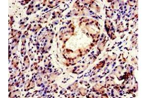 Immunohistochemistry of paraffin-embedded human pancreatic tissue using ABIN7147925 at dilution of 1:100 (CPSF6 anticorps  (AA 186-226))