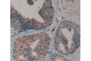 Used in DAB staining on fromalin fixed paraffin- embedded prostate gland tissue (COL6 anticorps  (AA 1-336))