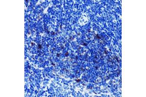 Immunohistochemistry of paraffin-embedded mouse spleen using S100B Rabbit mAb (ABIN7270131) at dilution of 1:100 (40x lens).