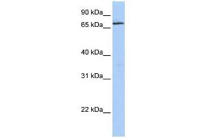 WB Suggested Anti-ZNF548 Antibody Titration:  0. (ZNF548 anticorps  (N-Term))