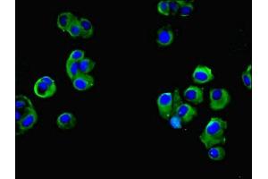 anti-Family with Sequence Similarity 118, Member A (FAM118A) (AA 51-357) antibody