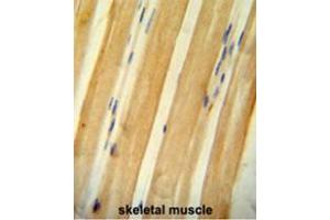 BCLAF1 antibody (C-term) immunohistochemistry analysis in formalin fixed and paraffin embedded human skeletal muscle followed by peroxidase conjugation of the secondary antibody and DAB staining. (BCLAF1 anticorps  (C-Term))