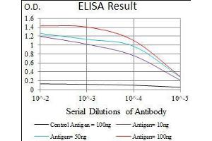 Black line: Control Antigen (100 ng), Purple line: Antigen(10 ng), Blue line: Antigen (50 ng), Red line: Antigen (100 ng),