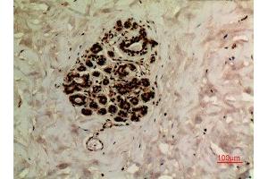 Immunohistochemistry (IHC) analysis of paraffin-embedded Human Breast, antibody was diluted at 1:100.