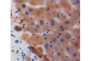 Used in DAB staining on fromalin fixed paraffin-embedded Liver tissue