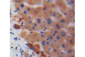 Used in DAB staining on fromalin fixed paraffin-embedded Liver tissue (IL17C anticorps  (AA 36-187))