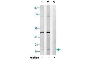 Western blot analysis of extracts from K-562 cells (Lane 1) and Jurkat cells (Lane 2 and lane 3), using C6orf108 polyclonal antibody . (RCL anticorps)