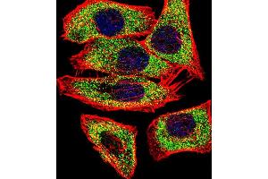 Fluorescent confocal image of  cell stained with TGM2 Antibody (Center ) (ABIN392285 and ABIN2841950).