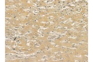 ABIN6265508 and ABIN6273329 at 1/100 staining human normal lung tissue by IHC-P. (TCTN2 anticorps  (Internal Region))