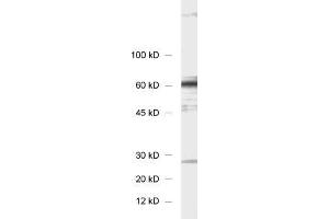 dilution: 1 : 1000, sample: 3T3 fibroblasts (STXBP4 anticorps)