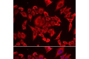 Immunofluorescence analysis of HeLa cells using SLC20A2 Polyclonal Antibody (SLC20A2 anticorps)