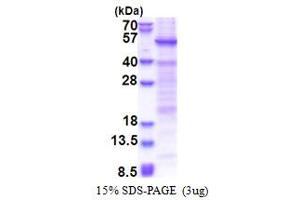 Heat Shock Transcription Factor, Y-Linked 1 (HSFY1) (AA 1-401) protein (His tag)