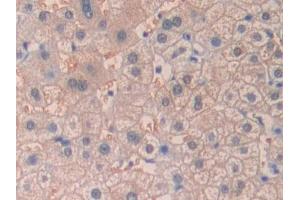 IHC-P analysis of Human Liver Tissue, with DAB staining. (desert Hedgehog anticorps  (AA 241-383))
