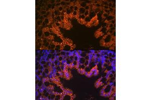 Immunofluorescence analysis of mouse large intestine using LI Cadherin/Cadherin-17 Rabbit mAb (ABIN7268249) at dilution of 1:100 (40x lens).