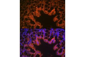 Immunofluorescence analysis of mouse large intestine using LI Cadherin/Cadherin-17 Rabbit mAb (ABIN7268249) at dilution of 1:100 (40x lens). (LI Cadherin anticorps)